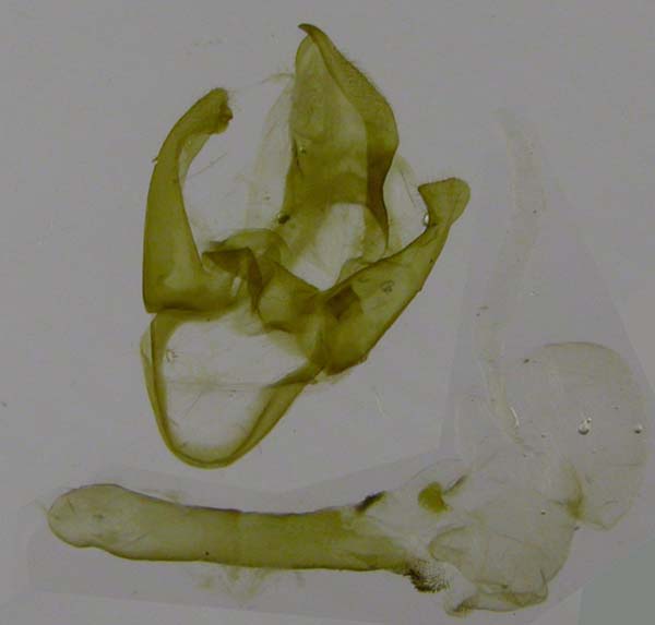 male genitalia, color image