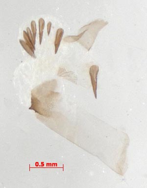 Miltochrista pallida, aedeagus, colour image